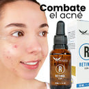 Retinol Afrodita - QuieroMás Magazine