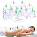 Vacumterapia 12 Piezas - QuieroMás Magazine