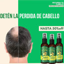 EELHOE King Of Ginger® Crecimiento Capilar en Spray - PAGA 2 LLEVA 3 - QuieroMás Magazine