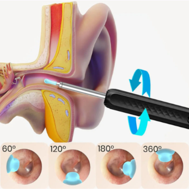 KIT 8 PIEZAS | LimpiaOídos Ultra™ con Cámara HD - La Solución Definitiva para tus Oídos 👂🌟 - QuieroMás Magazine