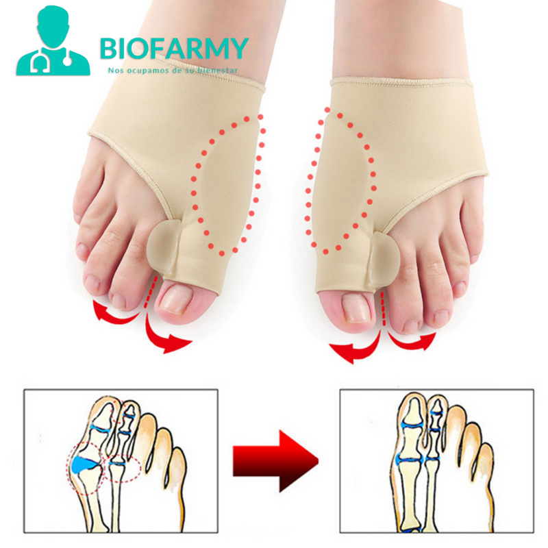 Corrector Juanetes BioFarmy® - QuieroMás Magazine