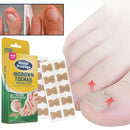 (PIDE 10 y LLEVA 20) Encravax - Parches Para Hongos y Uñas Encarnadas - QuieroMás Magazine