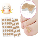 (PIDE 10 y LLEVA 20) Encravax - Parches Para Hongos y Uñas Encarnadas - QuieroMás Magazine