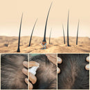 EELHOE King Of Ginger® Crecimiento Capilar en Spray - PAGA 2 LLEVA 3 - QuieroMás Magazine